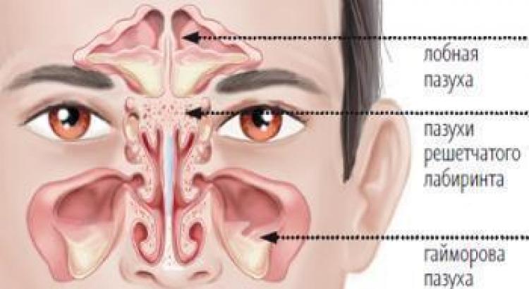 Aquamaris dari flu biasa Mencuci hidung dan organ THT lainnya dengan Aqua Maris